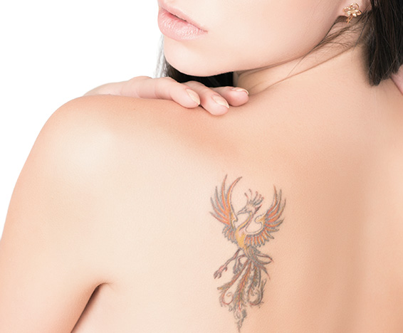 纹身 · 点痣 · 其他